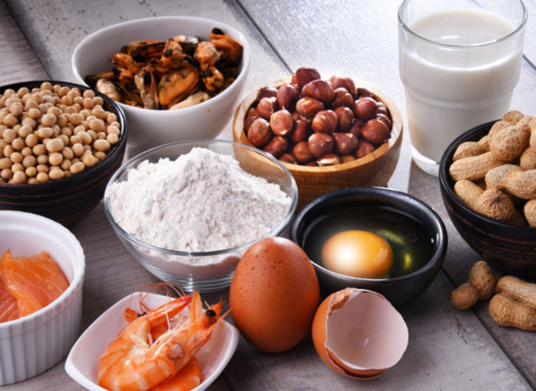 Allergen Awareness Built for High-Risk Service Environments